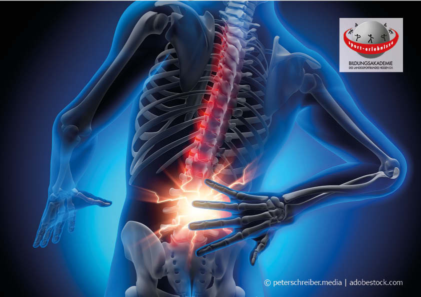 Anatomische Ansicht des Rückens mit Scherzen im ISG Iliosakralgelenk Rückenscherzen Rückentraining